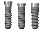 Different types of dental implants