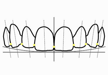 Illustrative image of smile design