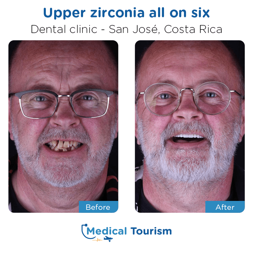 dental clinic before and after of patients in San José