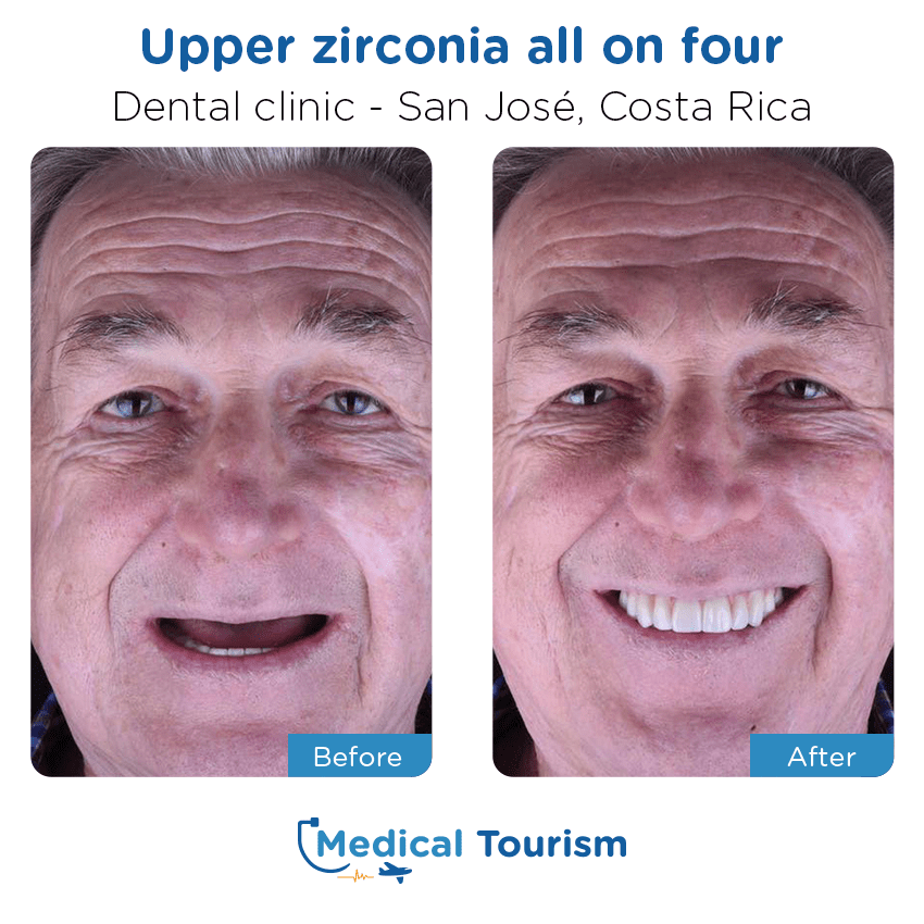 dental clinic before and after of patients in San José